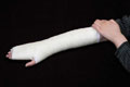 Orthopaedic Fiberglass Casting Splint2408