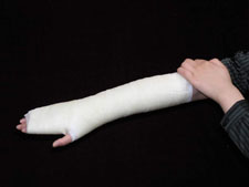 Orthopedic Fiberglass Casting Tapes
