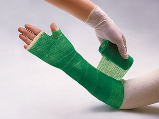 Multi Color Orthopedic Fiberglass Casting Tapes